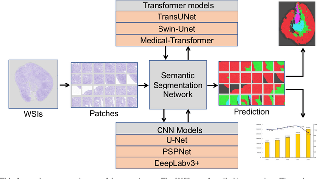 Figure 1 for Evaluation Kidney Layer Segmentation on Whole Slide Imaging using Convolutional Neural Networks and Transformers