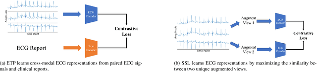 Figure 1 for ETP: Learning Transferable ECG Representations via ECG-Text Pre-training