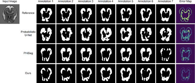 Figure 3 for Inter-Rater Uncertainty Quantification in Medical Image Segmentation via Rater-Specific Bayesian Neural Networks