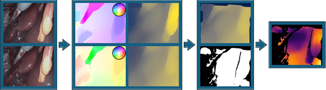 Figure 3 for Transferring Relative Monocular Depth to Surgical Vision with Temporal Consistency