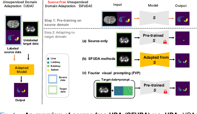 Figure 1 for FVP: Fourier Visual Prompting for Source-Free Unsupervised Domain Adaptation of Medical Image Segmentation