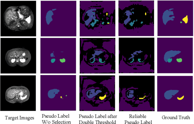 Figure 2 for FVP: Fourier Visual Prompting for Source-Free Unsupervised Domain Adaptation of Medical Image Segmentation