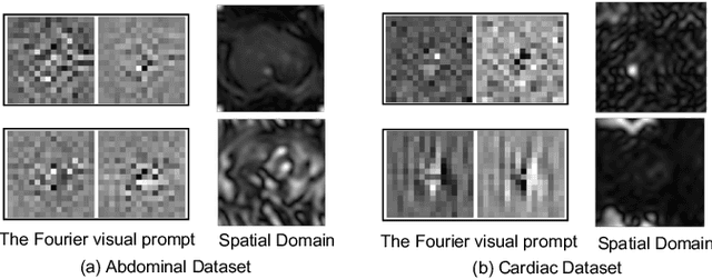 Figure 3 for FVP: Fourier Visual Prompting for Source-Free Unsupervised Domain Adaptation of Medical Image Segmentation