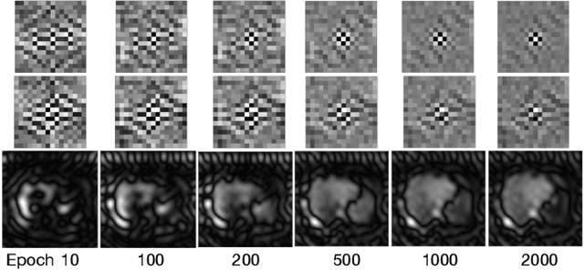 Figure 4 for FVP: Fourier Visual Prompting for Source-Free Unsupervised Domain Adaptation of Medical Image Segmentation