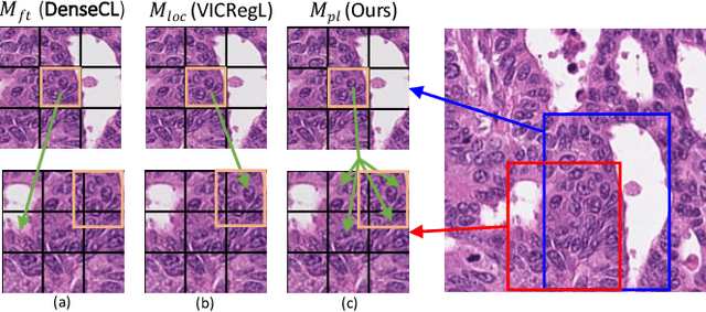 Figure 1 for Precise Location Matching Improves Dense Contrastive Learning in Digital Pathology