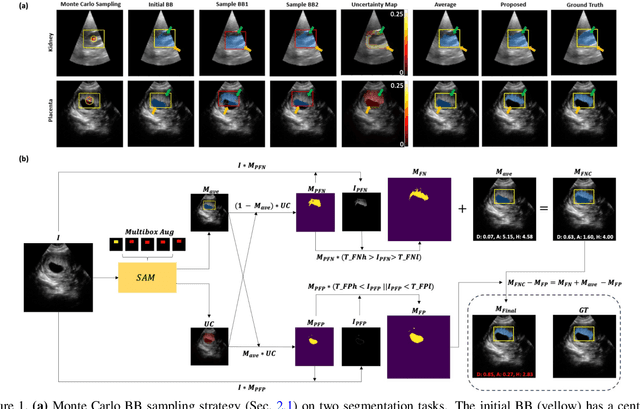 Figure 1 for False Negative/Positive Control for SAM on Noisy Medical Images