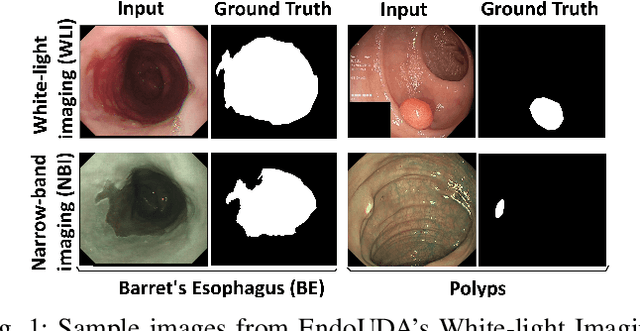 Figure 1 for SUPRA: Superpixel Guided Loss for Improved Multi-modal Segmentation in Endoscopy