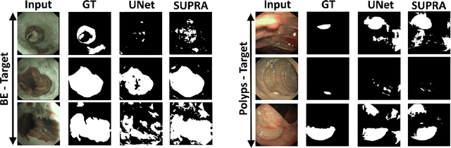 Figure 3 for SUPRA: Superpixel Guided Loss for Improved Multi-modal Segmentation in Endoscopy