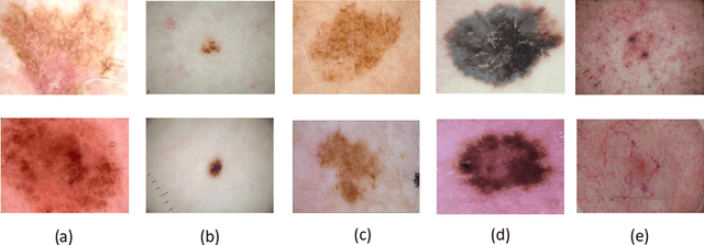 Figure 1 for Progressive Class-Wise Attention (PCA) Approach for Diagnosing Skin Lesions