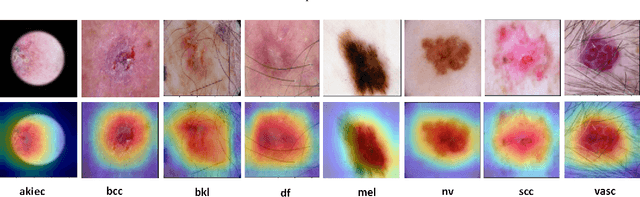 Figure 4 for Progressive Class-Wise Attention (PCA) Approach for Diagnosing Skin Lesions