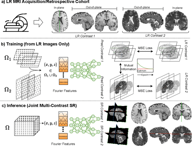 Figure 1 for Multi-contrast MRI Super-resolution via Implicit Neural Representations