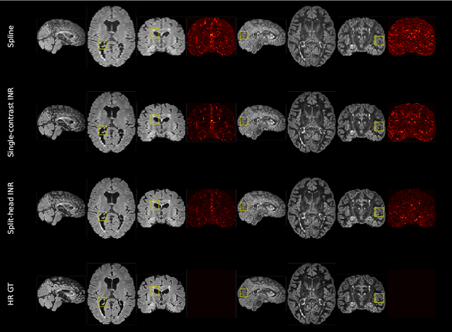 Figure 3 for Multi-contrast MRI Super-resolution via Implicit Neural Representations