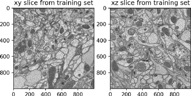 Figure 4 for Stretched sinograms for limited-angle tomographic reconstruction with neural networks