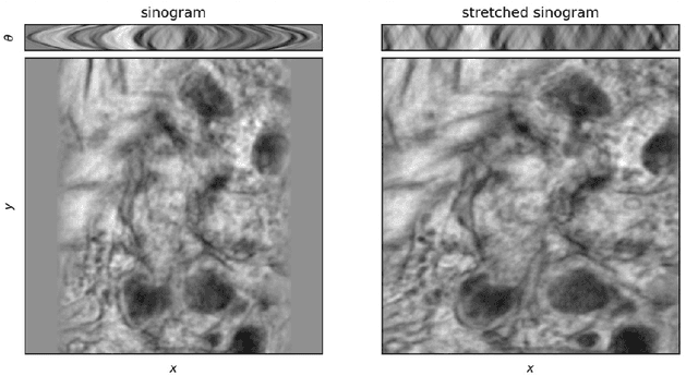 Figure 2 for Stretched sinograms for limited-angle tomographic reconstruction with neural networks