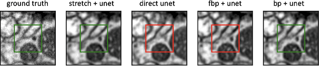 Figure 3 for Stretched sinograms for limited-angle tomographic reconstruction with neural networks