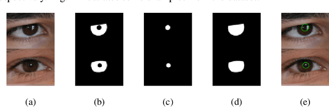 Figure 1 for Direct Estimation of Pupil Parameters Using Deep Learning for Visible Light Pupillometry