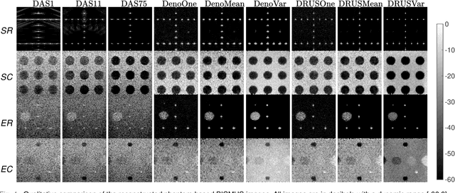 Figure 4 for Diffusion Reconstruction of Ultrasound Images with Informative Uncertainty