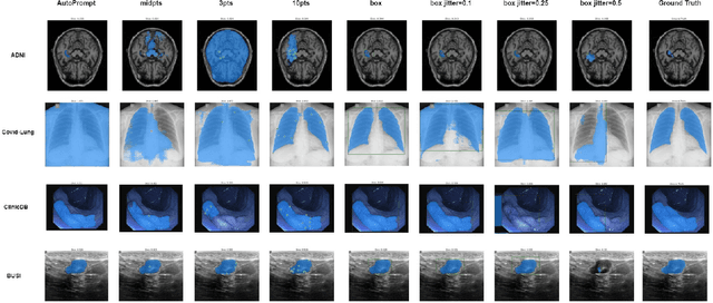 Figure 3 for SAM on Medical Images: A Comprehensive Study on Three Prompt Modes