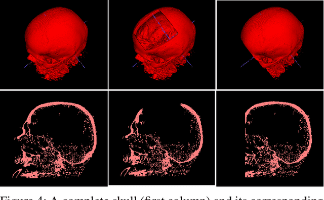 Figure 3 for Open-Source Skull Reconstruction with MONAI