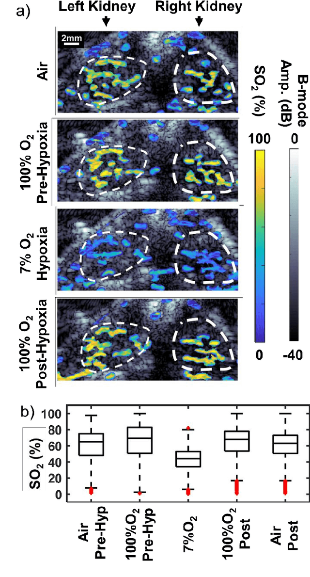 Figure 4 for Motion rejection and spectral unmixing for accurate estimation of in vivo oxygen saturation using multispectral optoacoustic tomography