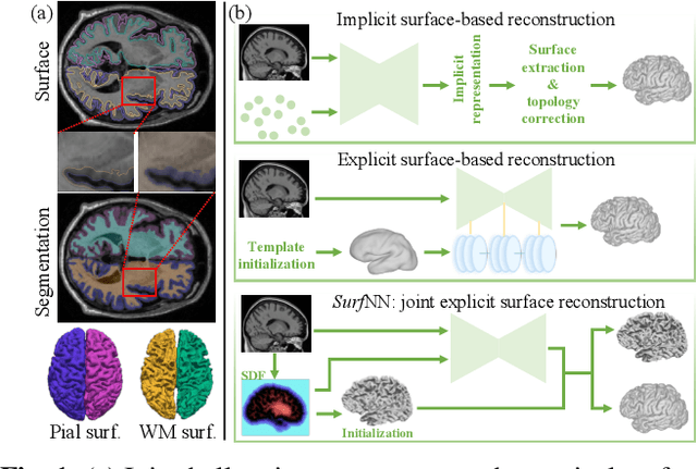 Figure 1 for SurfNN: Joint Reconstruction of Multiple Cortical Surfaces from Magnetic Resonance Images