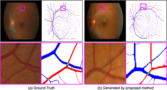 Figure 1 for Generation of Structurally Realistic Retinal Fundus Images with Diffusion Models