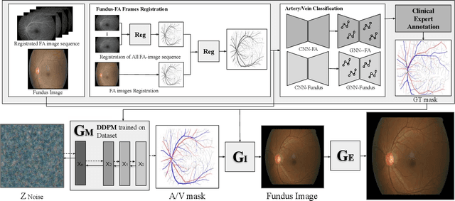 Figure 2 for Generation of Structurally Realistic Retinal Fundus Images with Diffusion Models