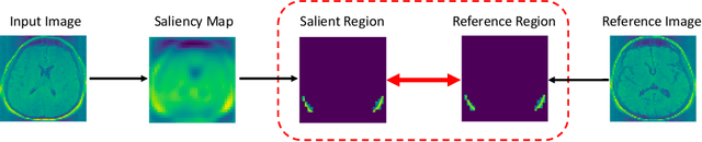 Figure 2 for Valid P-Value for Deep Learning-Driven Salient Region