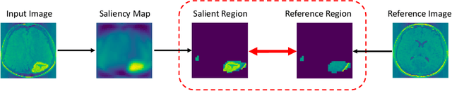 Figure 4 for Valid P-Value for Deep Learning-Driven Salient Region