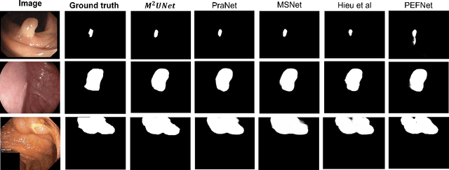 Figure 2 for M^2UNet: MetaFormer Multi-scale Upsampling Network for Polyp Segmentation