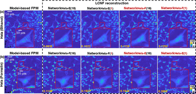 Figure 4 for Local Conditional Neural Fields for Versatile and Generalizable Large-Scale Reconstructions in Computational Imaging