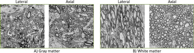 Figure 1 for Self-Supervised Super-Resolution Approach for Isotropic Reconstruction of 3D Electron Microscopy Images from Anisotropic Acquisition