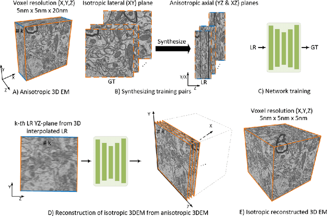 Figure 2 for Self-Supervised Super-Resolution Approach for Isotropic Reconstruction of 3D Electron Microscopy Images from Anisotropic Acquisition