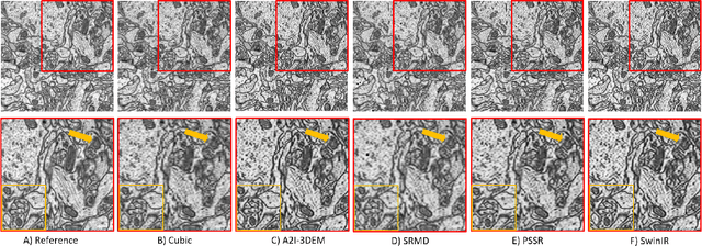 Figure 4 for Self-Supervised Super-Resolution Approach for Isotropic Reconstruction of 3D Electron Microscopy Images from Anisotropic Acquisition