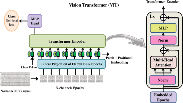 Figure 3 for Lightweight Convolution Transformer for Cross-patient Seizure Detection in Multi-channel EEG Signals