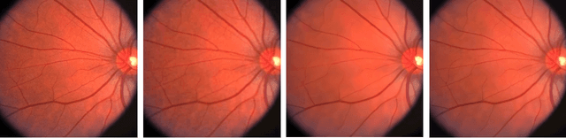 Figure 1 for Fine-tuned Generative Adversarial Network-based Model for Medical Images Super-Resolution