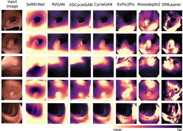 Figure 3 for SoftEnNet: Symbiotic Monocular Depth Estimation and Lumen Segmentation for Colonoscopy Endorobots