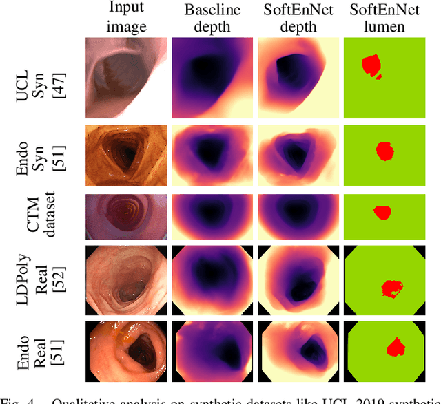 Figure 4 for SoftEnNet: Symbiotic Monocular Depth Estimation and Lumen Segmentation for Colonoscopy Endorobots