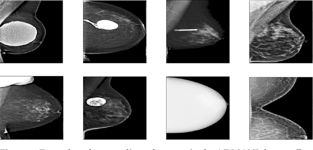 Figure 2 for Technical outlier detection via convolutional variational autoencoder for the ADMANI breast mammogram dataset