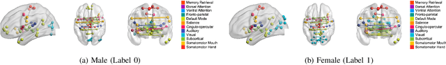 Figure 4 for Learning Task-Aware Effective Brain Connectivity for fMRI Analysis with Graph Neural Networks