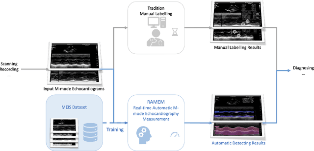 Figure 1 for Real-time Automatic M-mode Echocardiography Measurement with Panel Attention from Local-to-Global Pixels