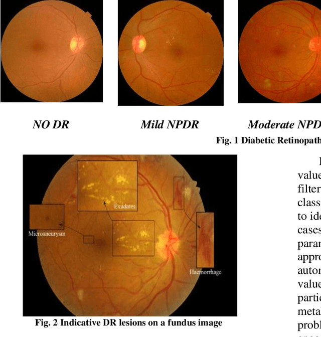 Figure 2 for Improving Classification of Retinal Fundus Image Using Flow Dynamics Optimized Deep Learning Methods