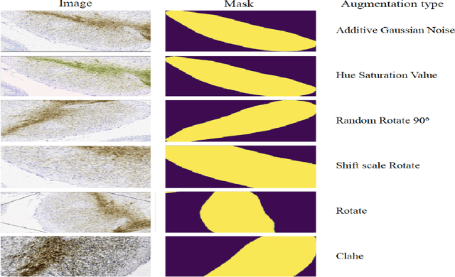 Figure 1 for Multiclass Semantic Segmentation to Identify Anatomical Sub-Regions of Brain and Measure Neuronal Health in Parkinson's Disease