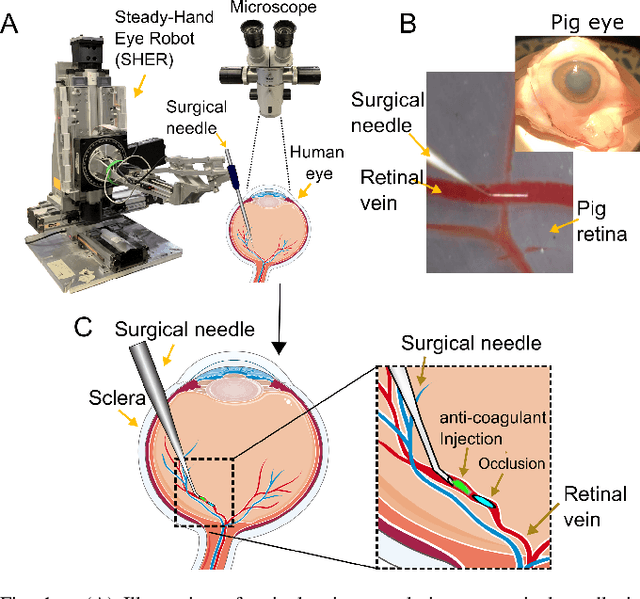 Figure 1 for Micromanipulation in Surgery: Autonomous Needle Insertion Inside the Eye for Targeted Drug Delivery