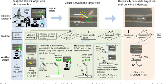 Figure 2 for Micromanipulation in Surgery: Autonomous Needle Insertion Inside the Eye for Targeted Drug Delivery