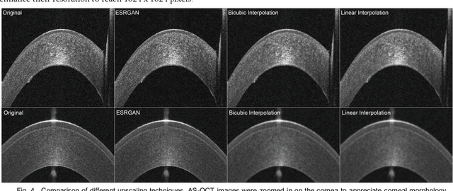 Figure 4 for Creating Realistic Anterior Segment Optical Coherence Tomography Images using Generative Adversarial Networks