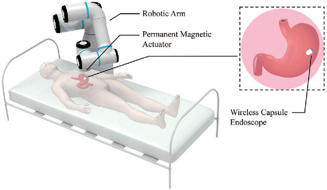 Figure 1 for Deep Reinforcement Learning-Based Control for Stomach Coverage Scanning of Wireless Capsule Endoscopy