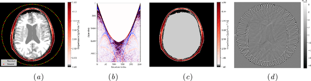 Figure 3 for Amortized Normalizing Flows for Transcranial Ultrasound with Uncertainty Quantification