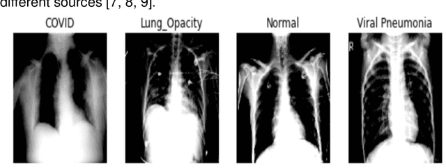 Figure 1 for Deep Learning For Classification Of Chest X-Ray Images (Covid 19)