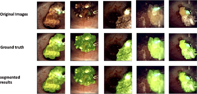 Figure 3 for SegPrompt: Using Segmentation Map as a Better Prompt to Finetune Deep Models for Kidney Stone Classification